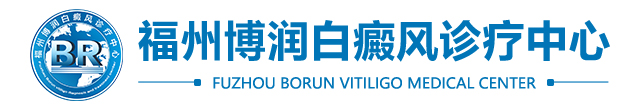 福州治疗白癜风-福州白癜风专科医院-福州白癜风医院哪家好-福州博润白癜风医院